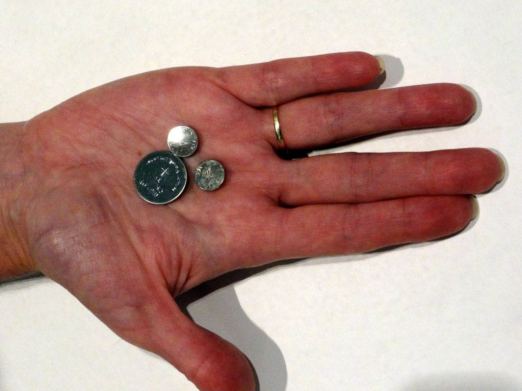 Button Batteries: Why They're so Dangerous