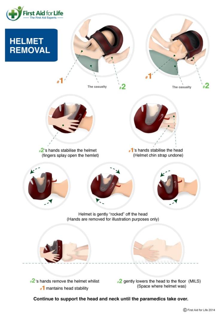 helmet removal infographic