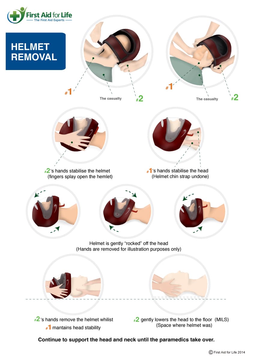 helmet removal infographic