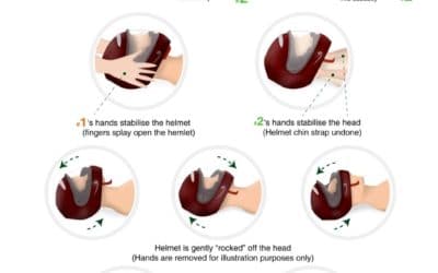 How and when to remove a motorcycle helmet following an accident