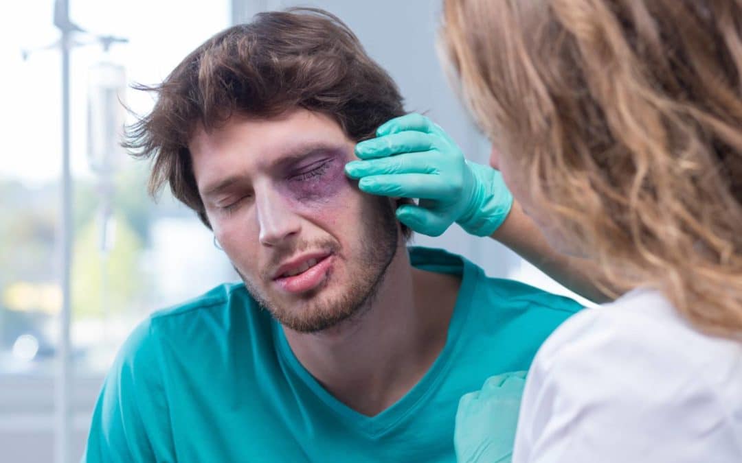 Eye injuries – The Most Common Causes and How to Help