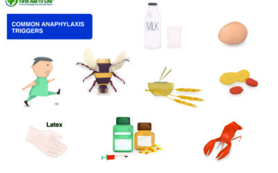 Food Allergies and Anaphylaxis – Triggers and How To Help