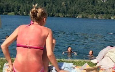 Sunscreen – common mistakes we make and should avoid