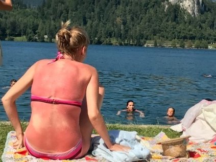 Sunscreen - common mistakes we make and should avoid