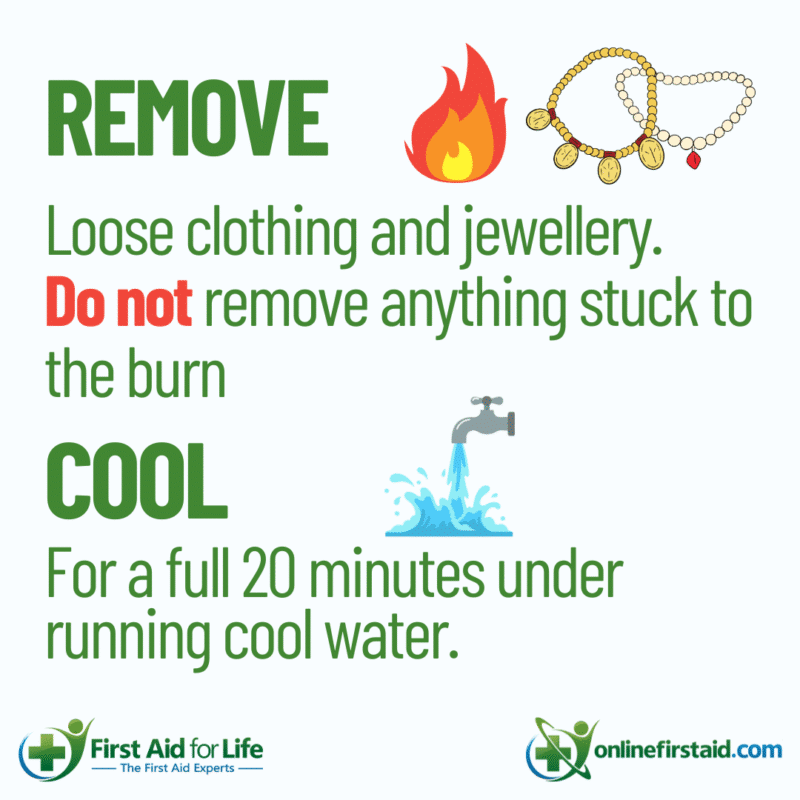 How to treat burns infographic