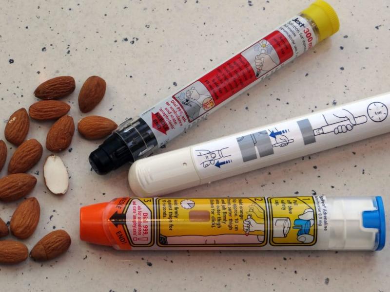 Allergic reaction Anaphylaxis