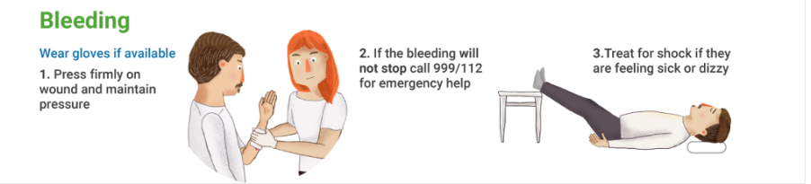 Bleeding - first aid