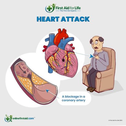 heart attack