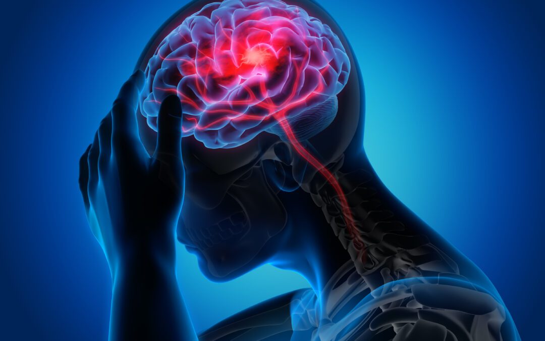 Strokes, how to spot them and what to do