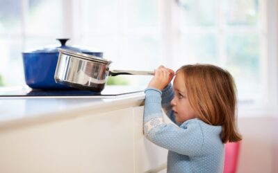 Burns and Scalds – What to Do
