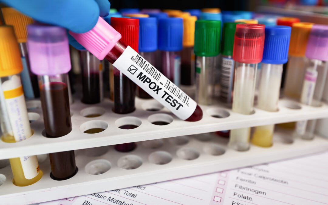 Mpox updated information