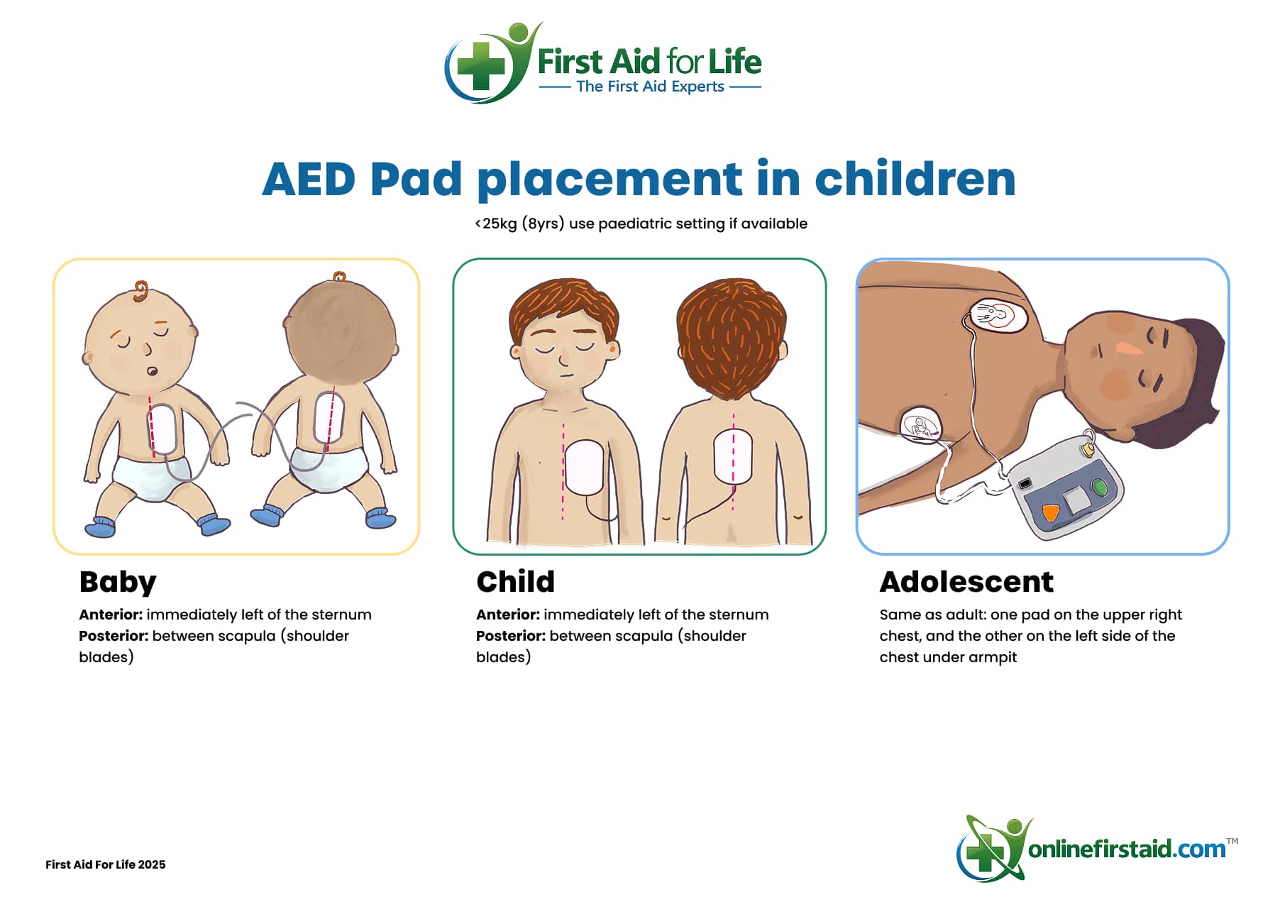 AED pad placement in children diagram