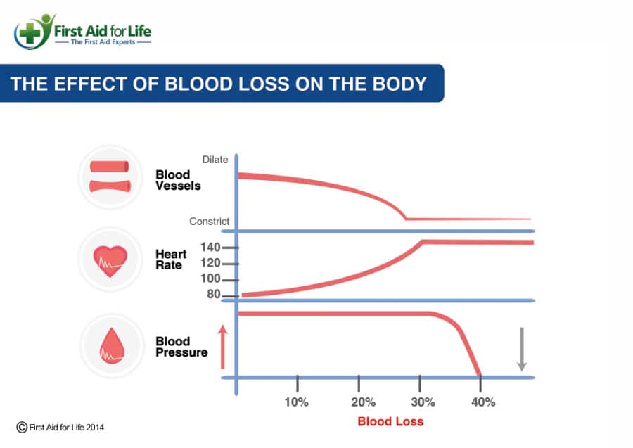 The Effect of Blood Loss on the Body poster