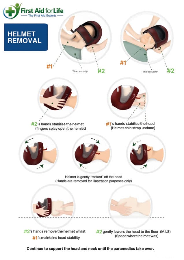 Helmet Removal poster