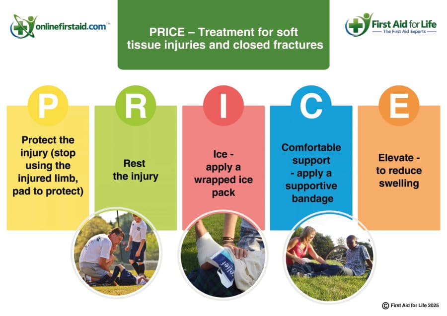 PRICE: Treating Soft Tissue Injuries and Fractures poster