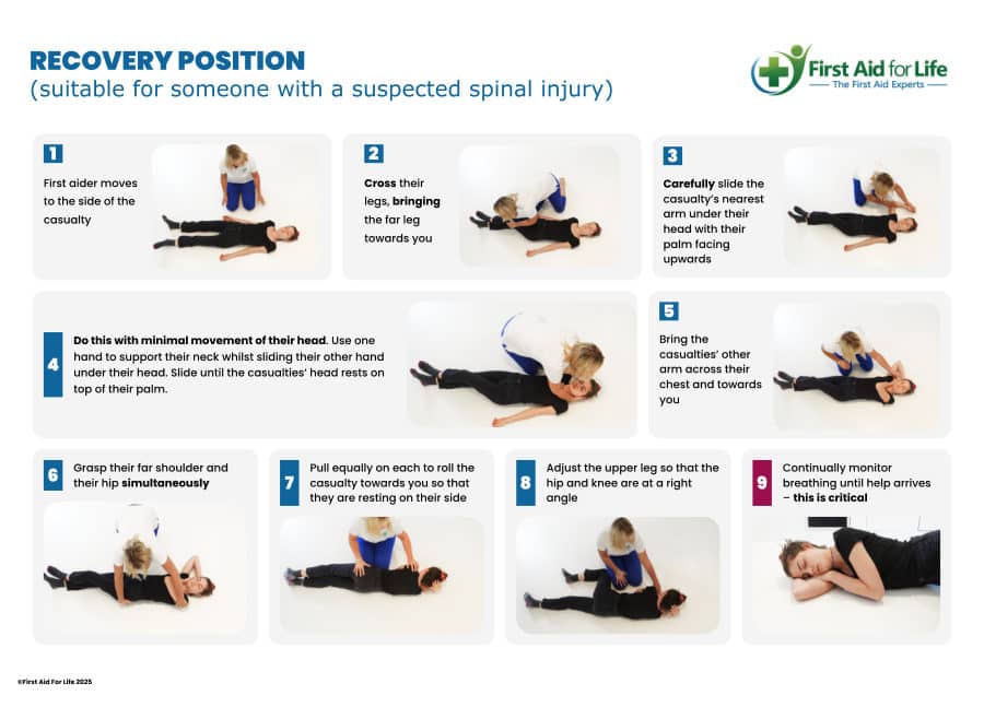 Recovery Position for a Suspected Spinal Injury poster