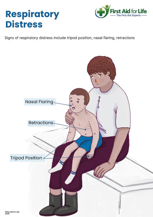 Respiratory Distress in Children poster